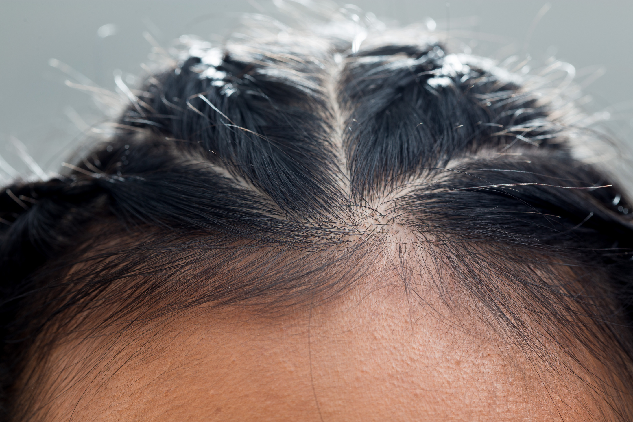 Body Part Hair root head skin close up woman