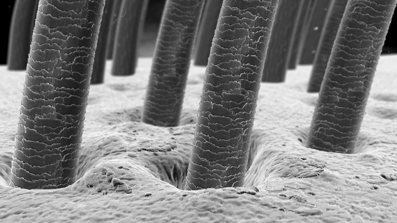 Hair under microscope